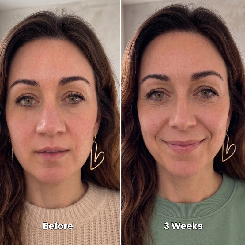 Customer photo of the Sculptique device